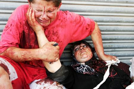 图文：受伤的黎巴嫩男孩子抚摸着妈妈的脸